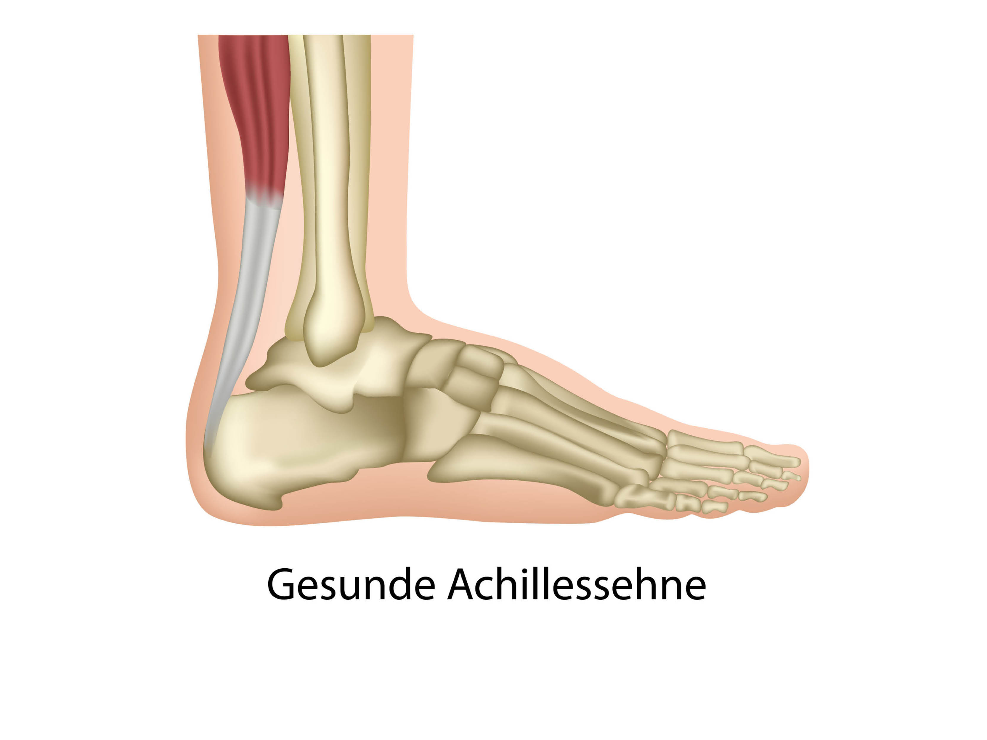 Neue Erkenntnisse: Warum die Achillessehne oft schmerzt – und was du ...